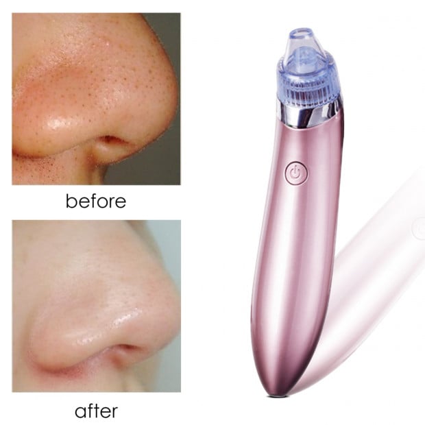 Electric Facial Skin Care Blackhead Cleaner - White Image 2